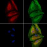 CANT1 Antibody in Immunocytochemistry (ICC/IF)