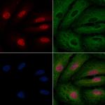 CCNK Antibody in Immunocytochemistry (ICC/IF)