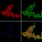 CD2AP Antibody in Immunocytochemistry (ICC/IF)