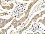 CD2AP Antibody in Immunohistochemistry (Paraffin) (IHC (P))