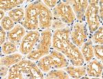 CD2AP Antibody in Immunohistochemistry (Paraffin) (IHC (P))