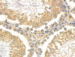 CD2AP Antibody in Immunohistochemistry (Paraffin) (IHC (P))