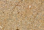 CD81 Antibody in Immunohistochemistry (Paraffin) (IHC (P))