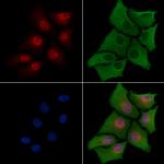 CITED2 Antibody in Immunocytochemistry (ICC/IF)