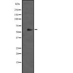 CYP2J2 Antibody in Western Blot (WB)