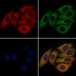 FGF8 Antibody in Immunocytochemistry (ICC/IF)