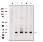 FGF8 Antibody in Western Blot (WB)