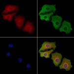 GPR83 Antibody in Immunocytochemistry (ICC/IF)