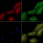 IL1F5 Antibody in Immunocytochemistry (ICC/IF)