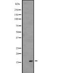 IL1F5 Antibody in Western Blot (WB)