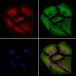 IL5RA (soluble) Antibody in Immunocytochemistry (ICC/IF)