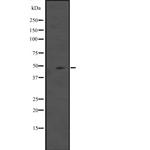 IL5RA (soluble) Antibody in Western Blot (WB)