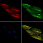 IL-9 Antibody in Immunocytochemistry (ICC/IF)