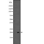 IL-20 Antibody in Western Blot (WB)