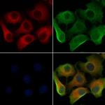 LAMTOR3 Antibody in Immunocytochemistry (ICC/IF)