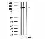 MSH3 Antibody in Western Blot (WB)