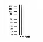 PIK3C2A Antibody in Western Blot (WB)