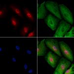 RAD1 Antibody in Immunocytochemistry (ICC/IF)