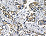 TAB2 Antibody in Immunohistochemistry (Paraffin) (IHC (P))