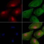 TAB3 Antibody in Immunocytochemistry (ICC/IF)