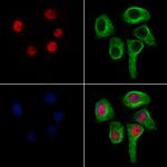 UBC3B Antibody in Immunocytochemistry (ICC/IF)