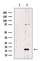 UBC3B Antibody in Western Blot (WB)