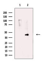 NCEH1 Antibody in Western Blot (WB)