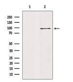 AAK1 Antibody in Western Blot (WB)