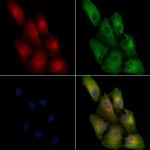 AASS Antibody in Immunocytochemistry (ICC/IF)