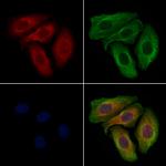 ABCB11 Antibody in Immunocytochemistry (ICC/IF)