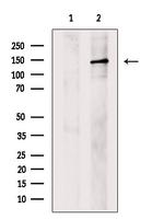 ABCB11 Antibody in Western Blot (WB)