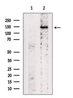 ABCB11 Antibody in Western Blot (WB)