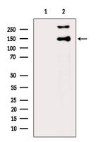 ABCB11 Antibody in Western Blot (WB)