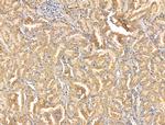 ABCB5 Antibody in Immunohistochemistry (Paraffin) (IHC (P))