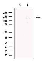 ABCB5 Antibody in Western Blot (WB)