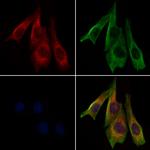 ABCD2 Antibody in Immunocytochemistry (ICC/IF)