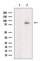 ABCD2 Antibody in Western Blot (WB)