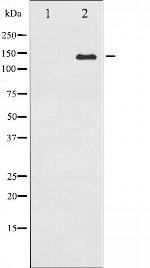 ABL1/ABL2 Antibody in Western Blot (WB)