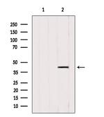 ACAA1 Antibody in Western Blot (WB)