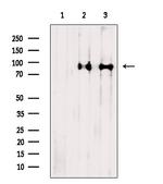 ACAP2 Antibody in Western Blot (WB)