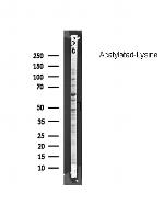 Acetylated Lysine Antibody in Western Blot (WB)