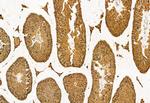 ACOX1 Antibody in Immunohistochemistry (Paraffin) (IHC (P))