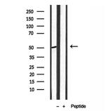 ACOX1 Antibody in Western Blot (WB)