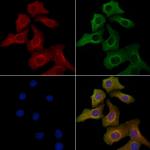 ACOX2 Antibody in Immunocytochemistry (ICC/IF)