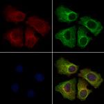 ACSL5 Antibody in Immunocytochemistry (ICC/IF)