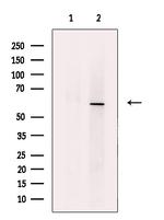 ACVR1 Antibody in Western Blot (WB)