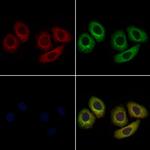 ACVR2A Antibody in Immunocytochemistry (ICC/IF)