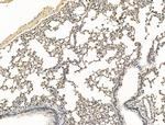 ADCY10 Antibody in Immunohistochemistry (Paraffin) (IHC (P))