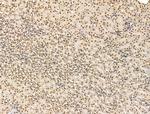 ADCY10 Antibody in Immunohistochemistry (Paraffin) (IHC (P))