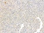 ADCY10 Antibody in Immunohistochemistry (Paraffin) (IHC (P))